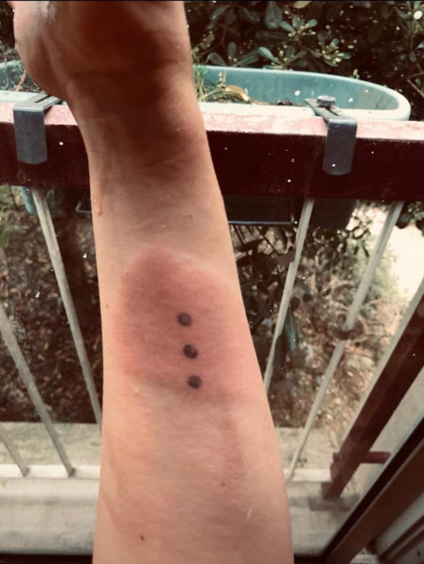 Coupe-feu – soulagement des brûlures