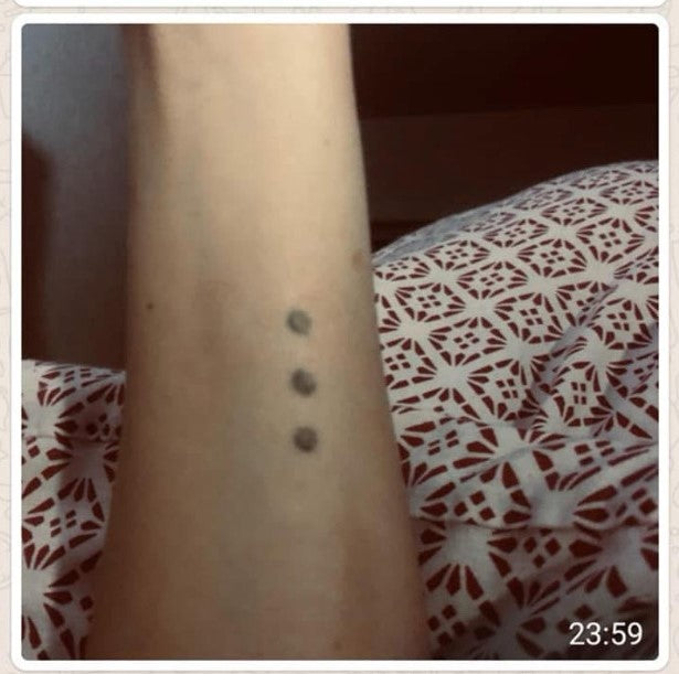 Coupe-feu – soulagement des brûlures